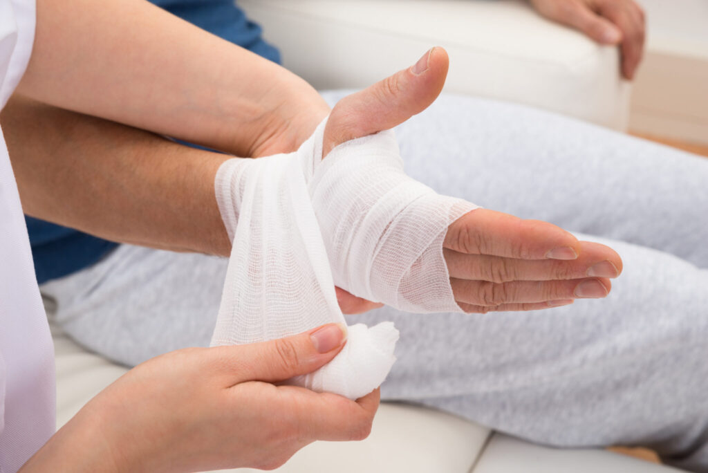 Hand Injury Image scaled